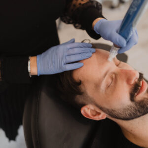 Skin Pen Microneedling Nashville & Gallatin
