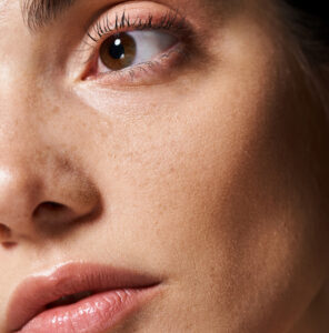 SkinPen Microneedling Nashville & Gallatin