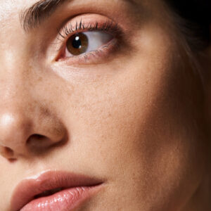 SkinPen Microneedling Nashville & Gallatin