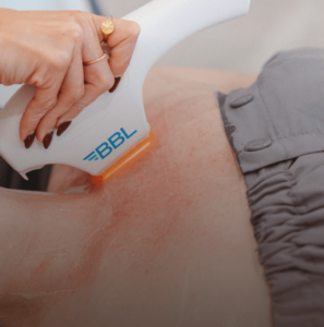 Skin Tightening Nashville & Gallatin